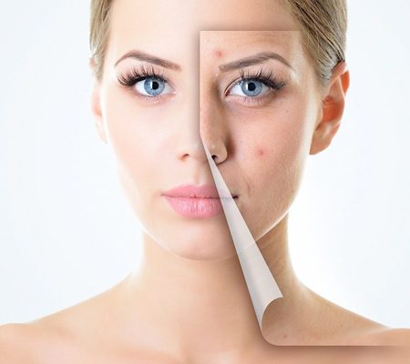 Skinbooster
