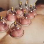 Alles wat je moet weten over cuppingtherapie 1