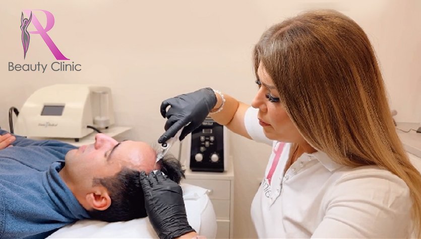 Haar Filler Behandeling