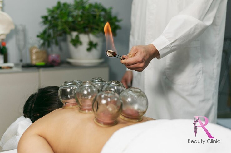 Cupping Warme massage Amsterdam