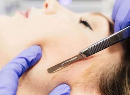 Derma Planing Behndeling Amsterdam