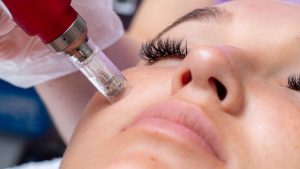 Gezichtsbehandeling + Nanoneedling Amsterdam