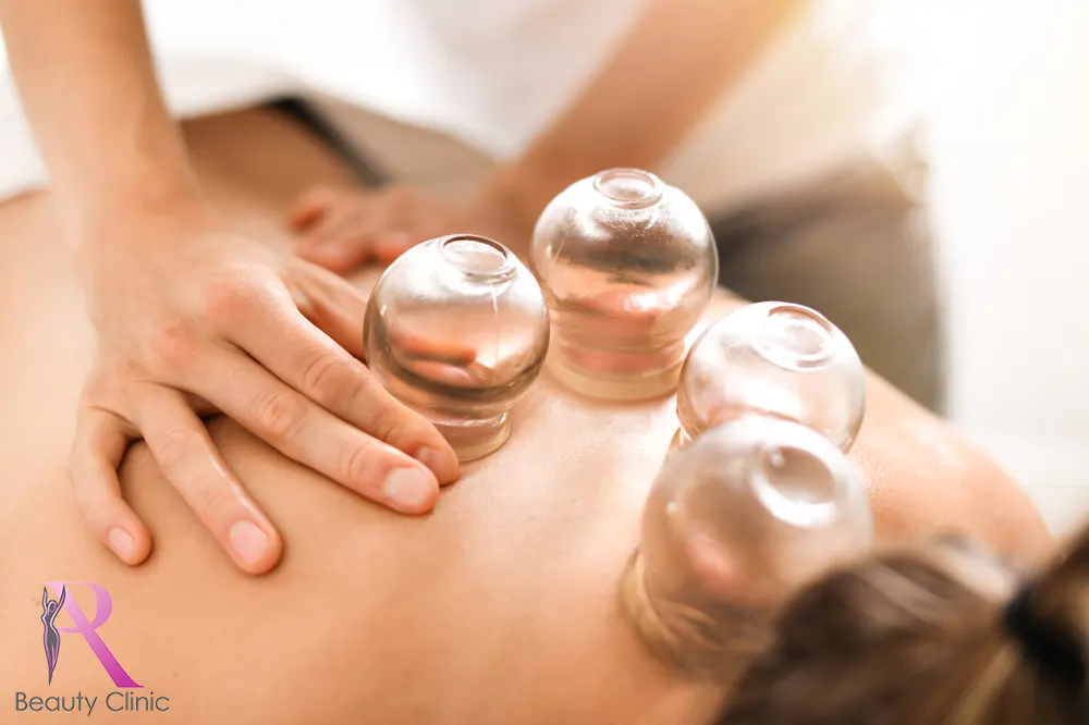 Alles wat je moet weten over cuppingtherapie