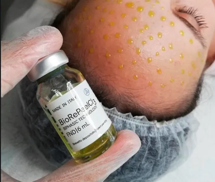 BIORePeelCL3 Peeling