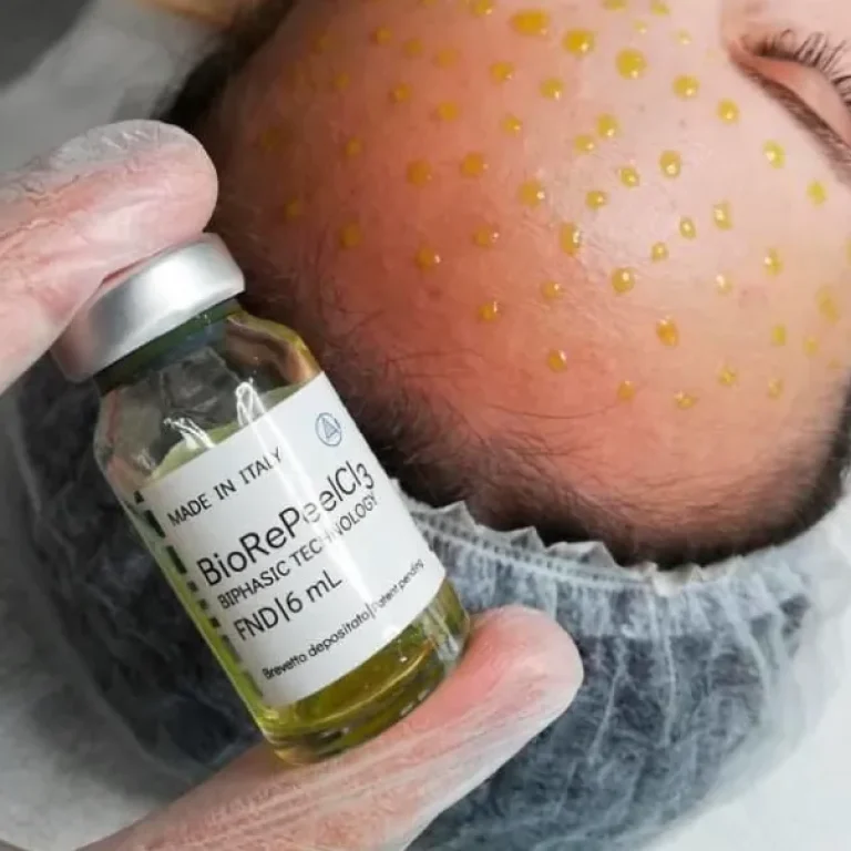 BIORePeelCL3 Peeling