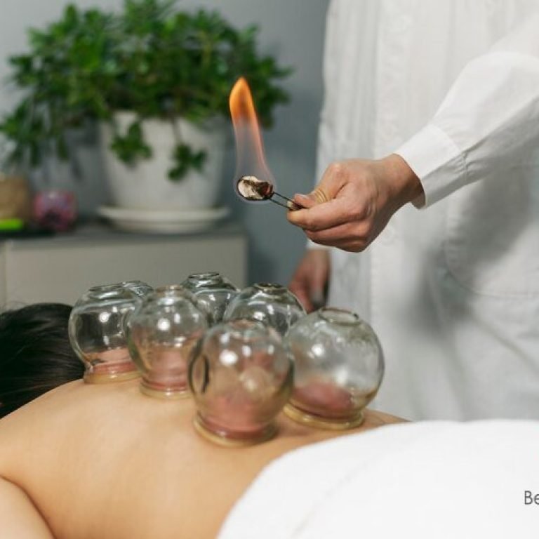 Cupping Warme massage Amsterdam
